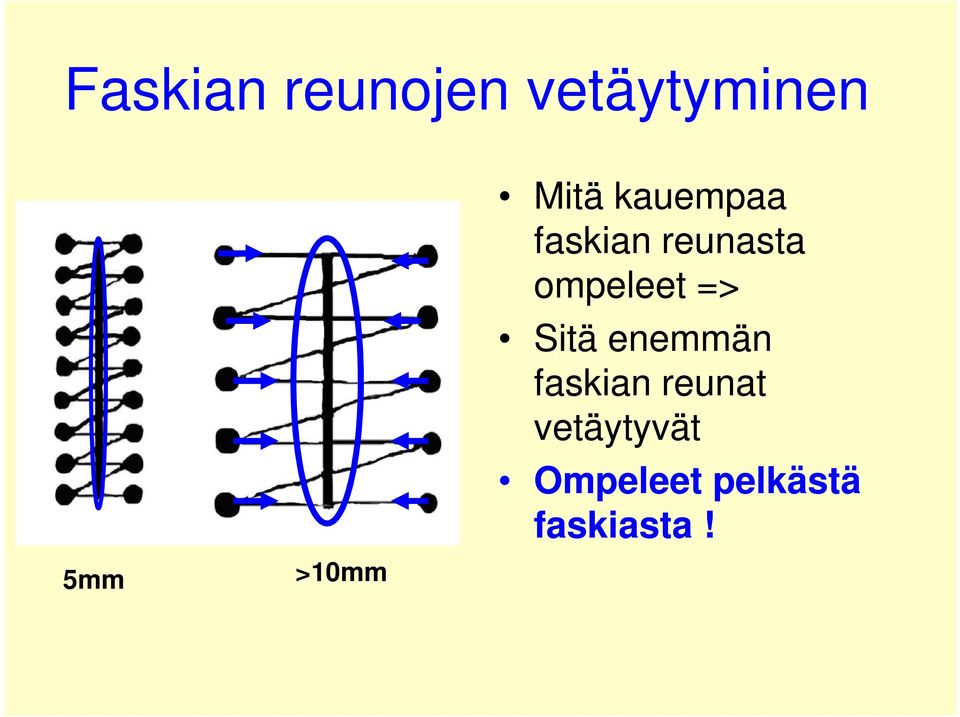 ompeleet => Sitä enemmän faskian