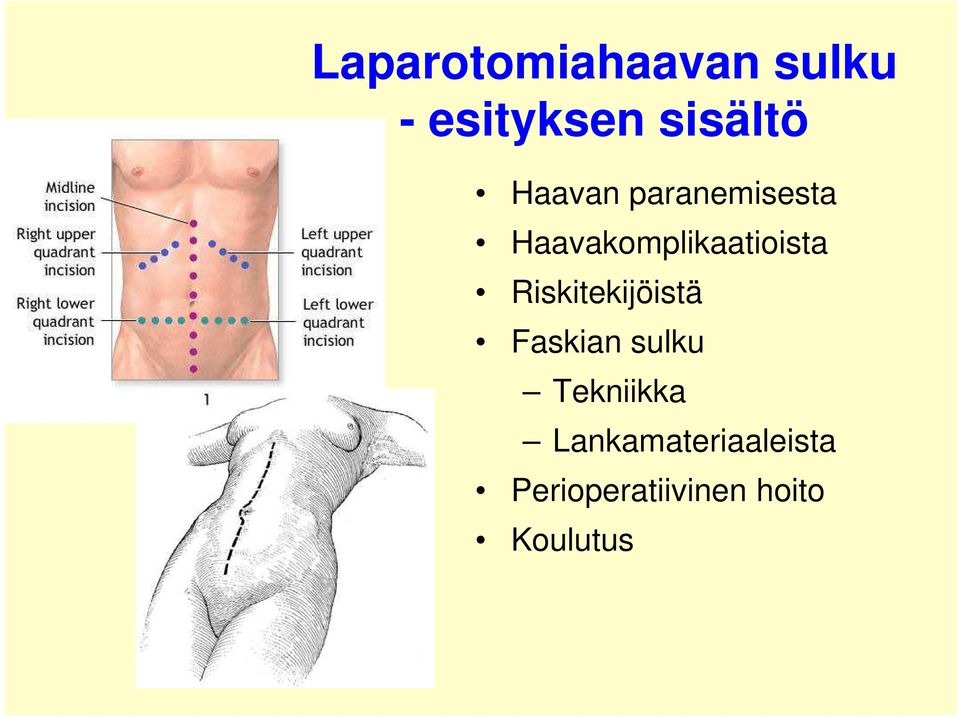 Riskitekijöistä Faskian sulku Tekniikka