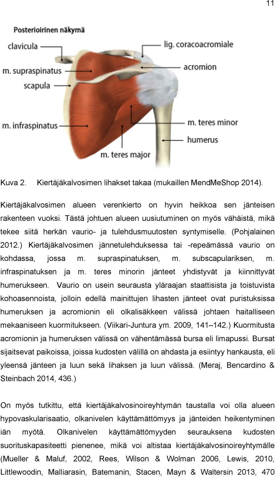 ) Kiertäjäkalvosimen jännetulehduksessa tai -repeämässä vaurio on kohdassa, jossa m. supraspinatuksen, m. subscapulariksen, m. infraspinatuksen ja m.