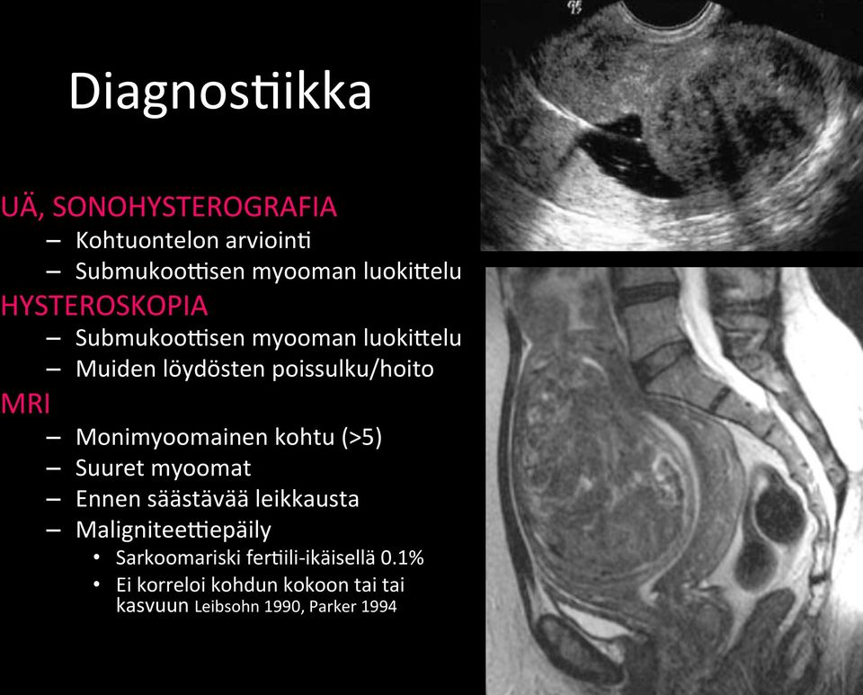 Monimyoomainen kohtu (>5) Suuret myoomat Ennen säästävää leikkausta Malignitee(epäily