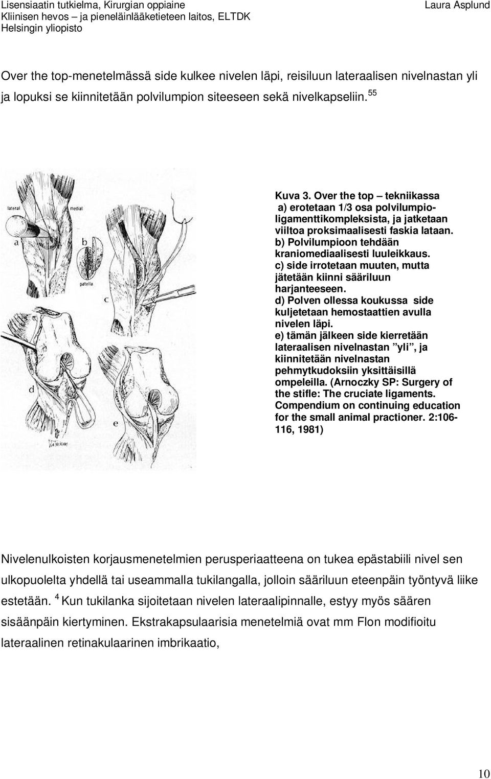 c) side irrotetaan muuten, mutta jätetään kiinni sääriluun harjanteeseen. d) Polven ollessa koukussa side kuljetetaan hemostaattien avulla nivelen läpi.