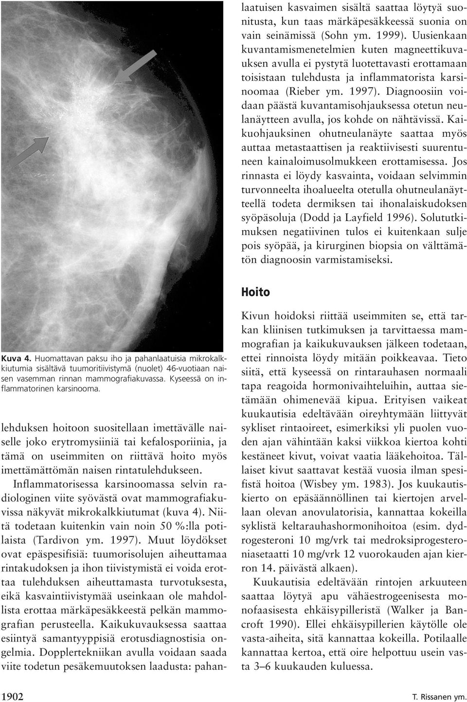 Diagnoosiin voidaan päästä kuvantamisohjauksessa otetun neulanäytteen avulla, jos kohde on nähtävissä.