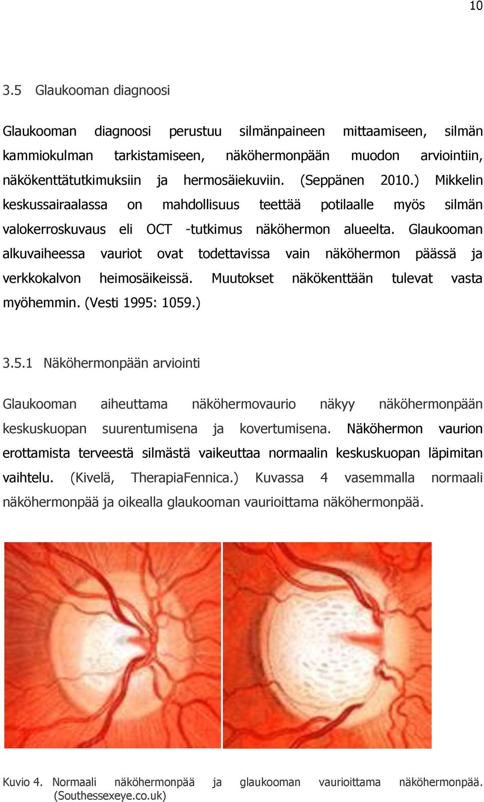 Glaukooman alkuvaiheessa vauriot ovat todettavissa vain näköhermon päässä ja verkkokalvon heimosäikeissä. Muutokset näkökenttään tulevat vasta myöhemmin. (Vesti 1995: