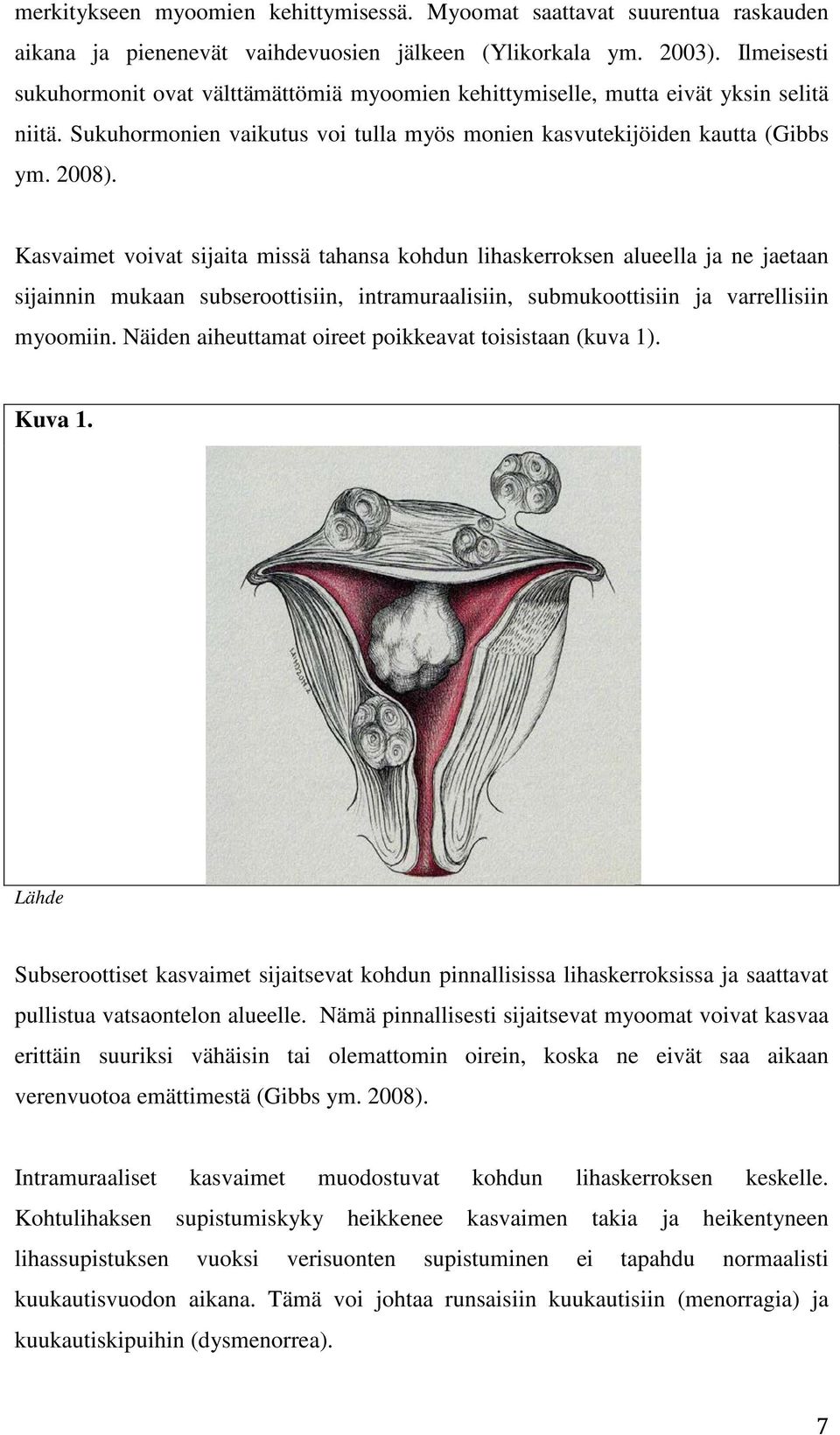 Kasvaimet voivat sijaita missä tahansa kohdun lihaskerroksen alueella ja ne jaetaan sijainnin mukaan subseroottisiin, intramuraalisiin, submukoottisiin ja varrellisiin myoomiin.
