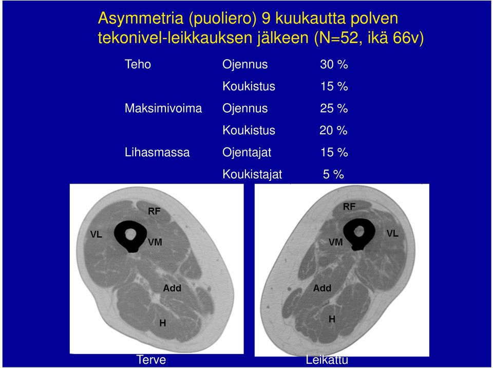 Ojennus 30 % Koukistus 15 % Maksimivoima Ojennus 25 %