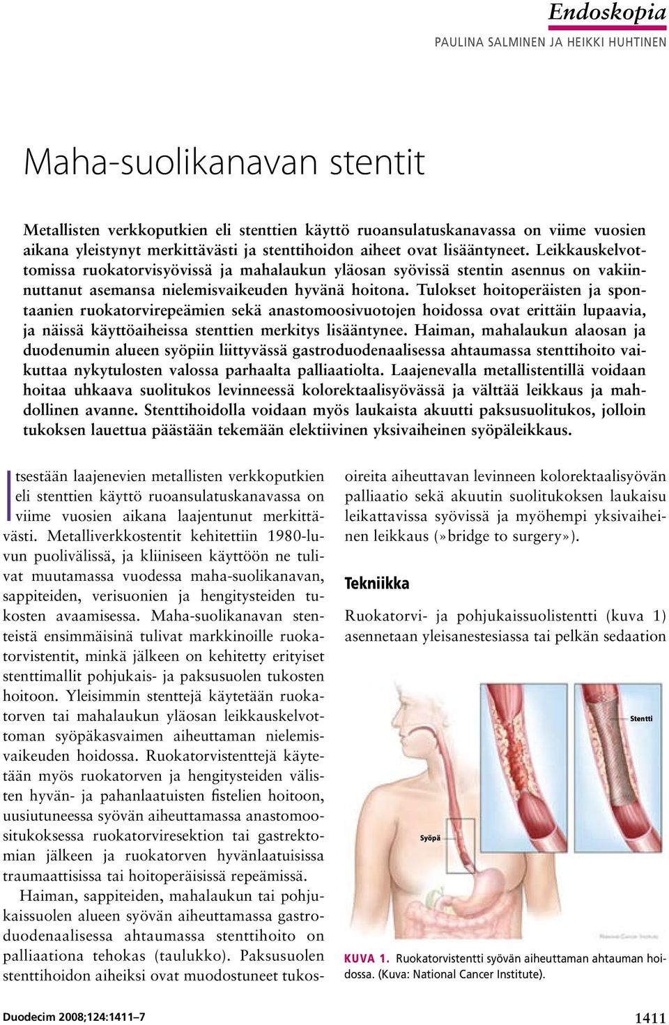 Tulokset hoitoperäisten ja spontaanien ruokatorvirepeämien sekä anastomoosivuotojen hoidossa ovat erittäin lupaavia, ja näissä käyttöaiheissa stenttien merkitys lisääntynee.