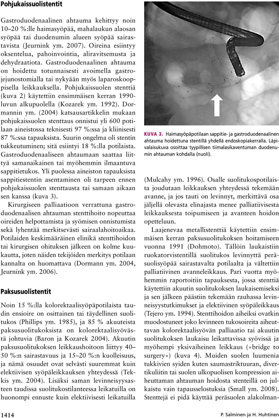 Gastroduodenaalinen ahtauma on hoidettu totunnaisesti avoimella gastrojejunostomialla tai nykyään myös laparoskooppisella leikkauksella.