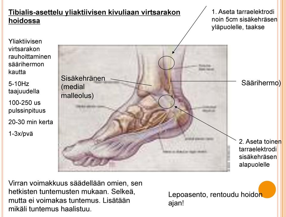 taajuudella 100-250 us pulssinpituus 20-30 min kerta 1-3x/pvä Sisäkehränen (medial malleolus) Säärihermo) 2.