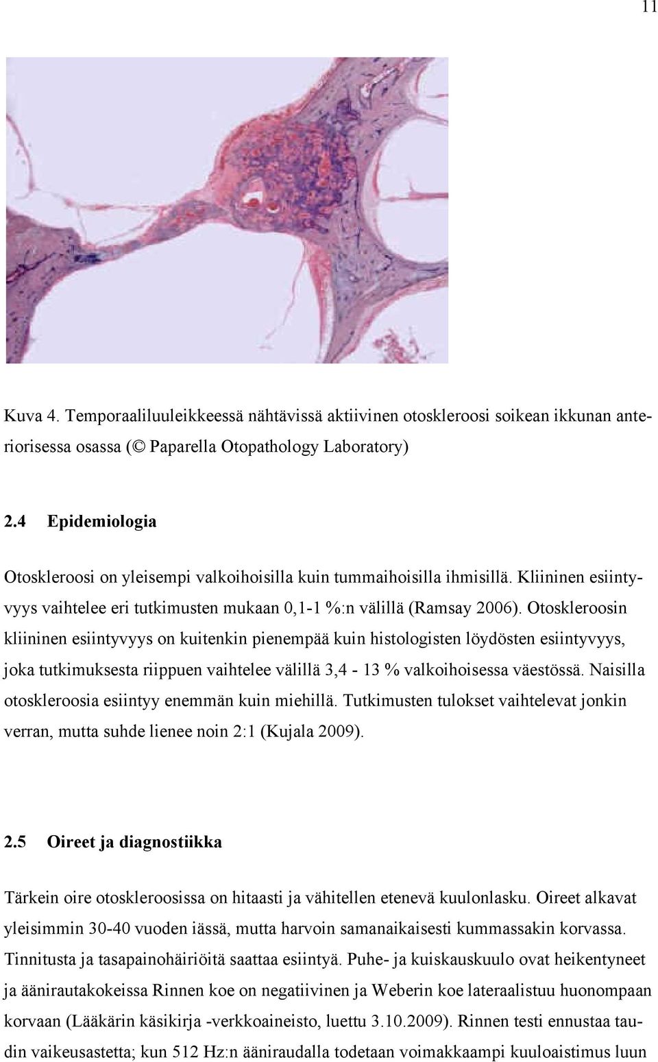 Otoskleroosin kliininen esiintyvyys on kuitenkin pienempää kuin histologisten löydösten esiintyvyys, joka tutkimuksesta riippuen vaihtelee välillä 3,4-13 % valkoihoisessa väestössä.