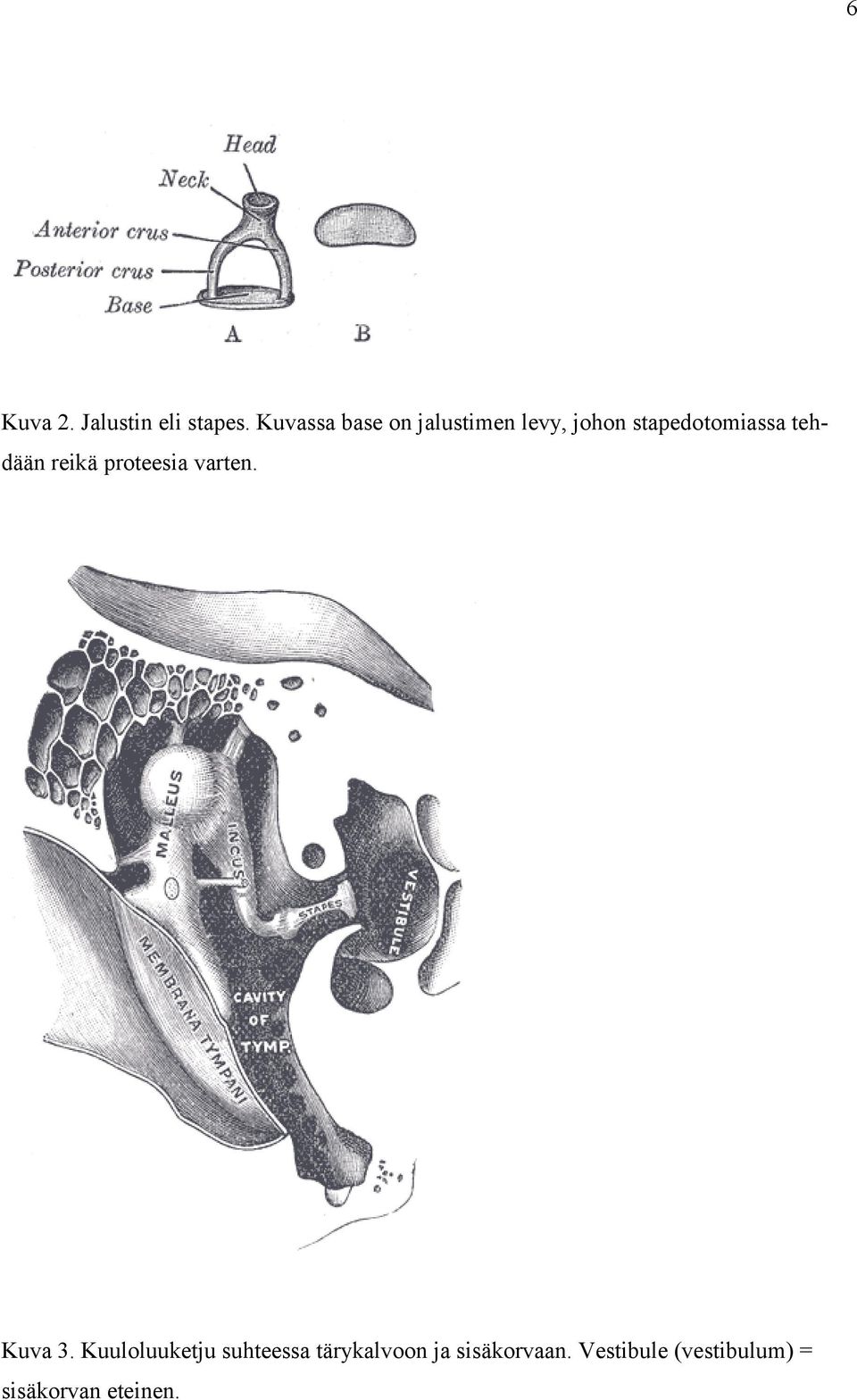 tehdään reikä proteesia varten. Kuva 3.