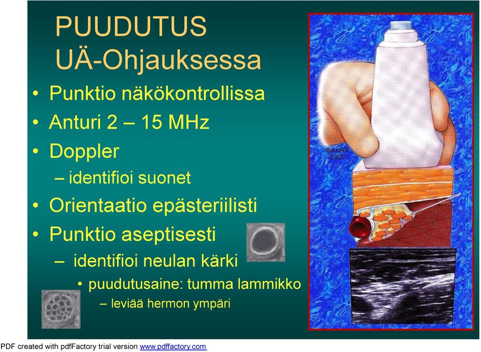 Orientaatio epästeriilisti Punktio aseptisesti