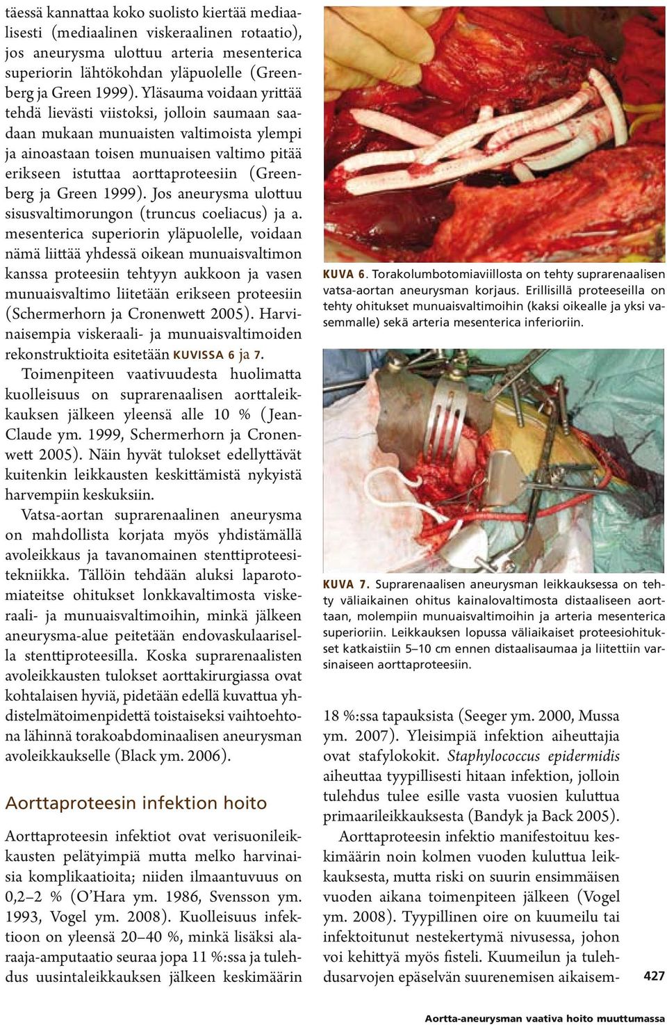 (Greenberg ja Green 1999). Jos aneurysma ulottuu sisusvaltimorungon (truncus coeliacus) ja a.