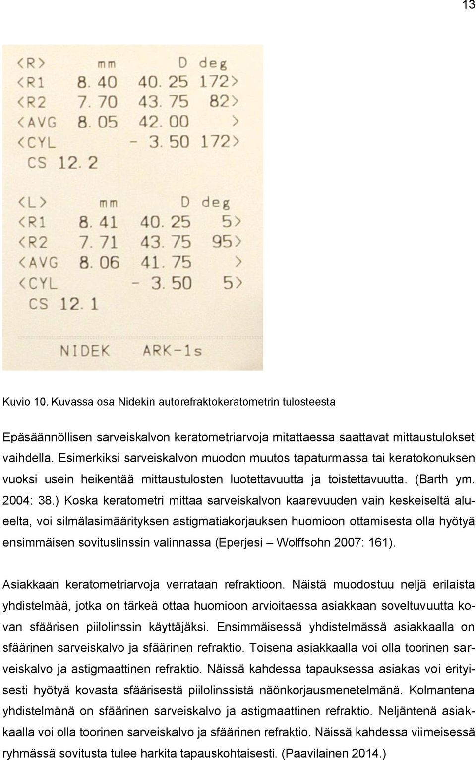 ) Koska keratometri mittaa sarveiskalvon kaarevuuden vain keskeiseltä alueelta, voi silmälasimäärityksen astigmatiakorjauksen huomioon ottamisesta olla hyötyä ensimmäisen sovituslinssin valinnassa