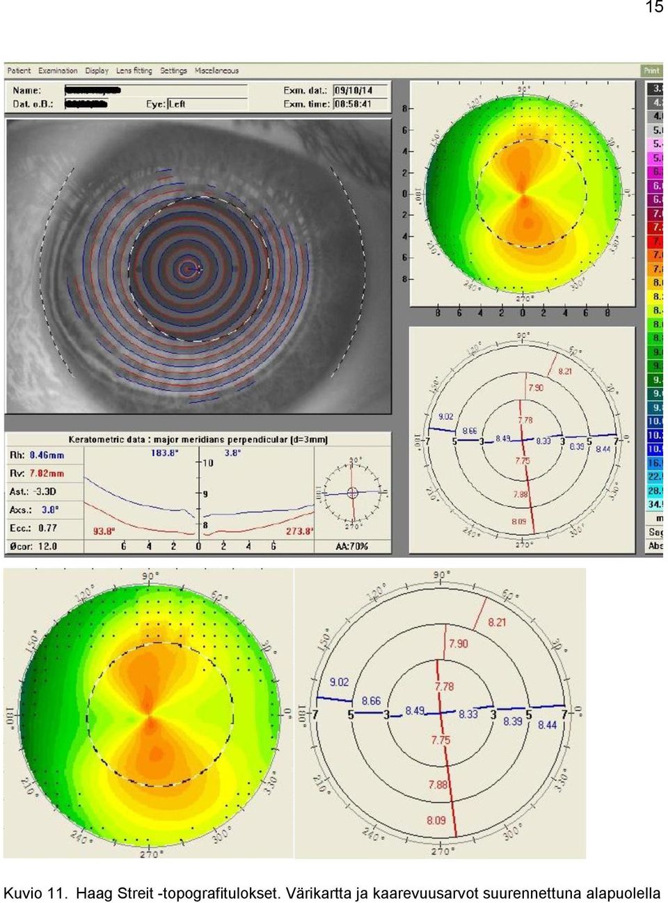 -topografitulokset.