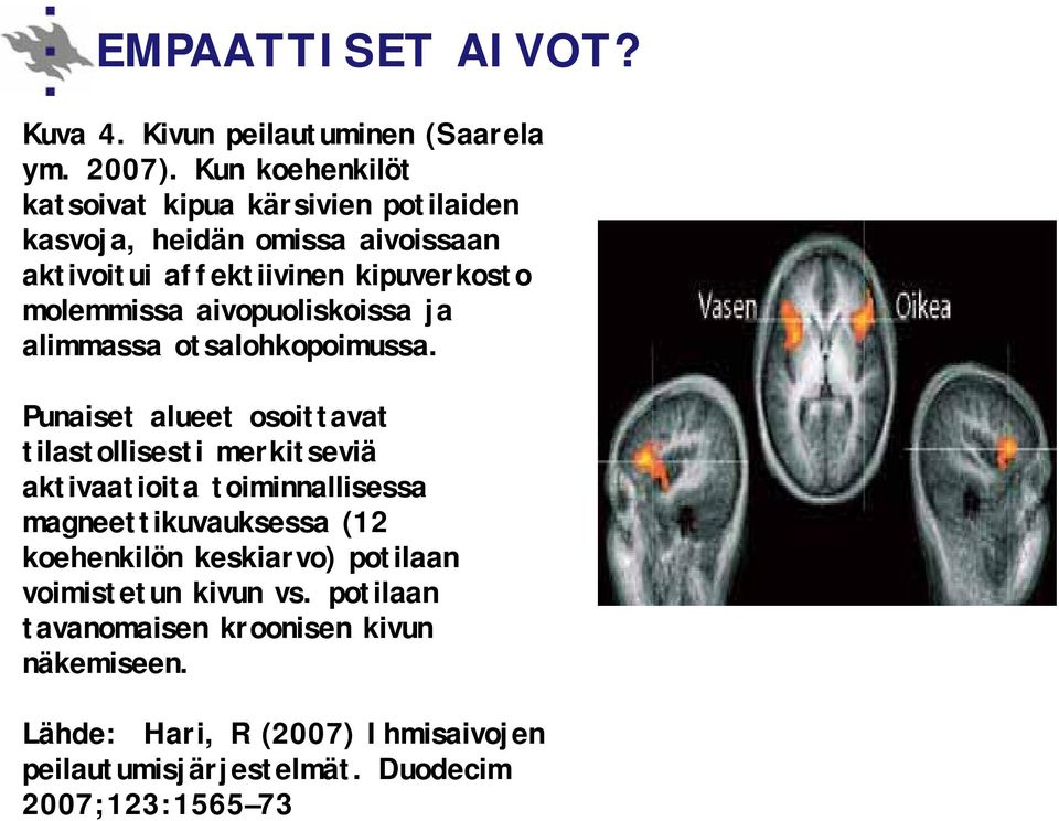 aivopuoliskoissa ja alimmassa otsalohkopoimussa.