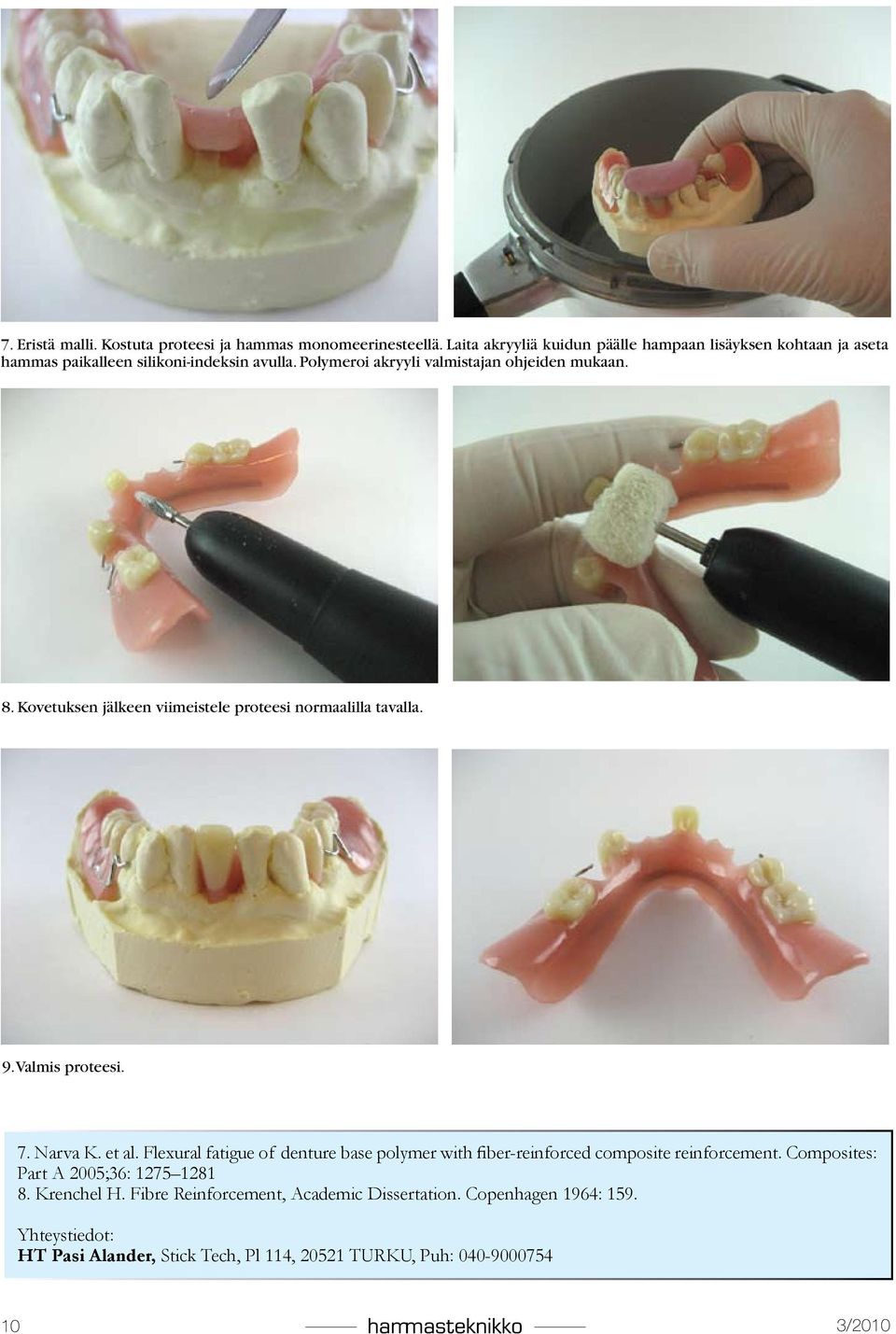 8. Kovetuksen jälkeen viimeistele proteesi normaalilla tavalla. 9. Valmis proteesi. 7. Narva K. et al.