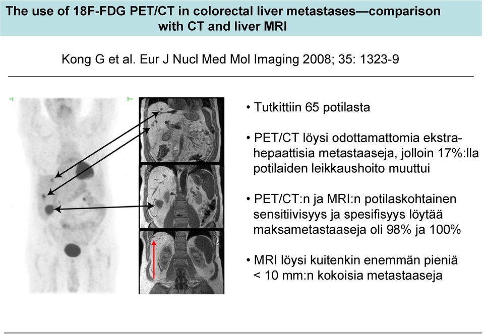 metastaaseja, jolloin 17%:lla potilaiden leikkaushoito muuttui PET/CT:n ja MRI:n potilaskohtainen sensitiivisyys