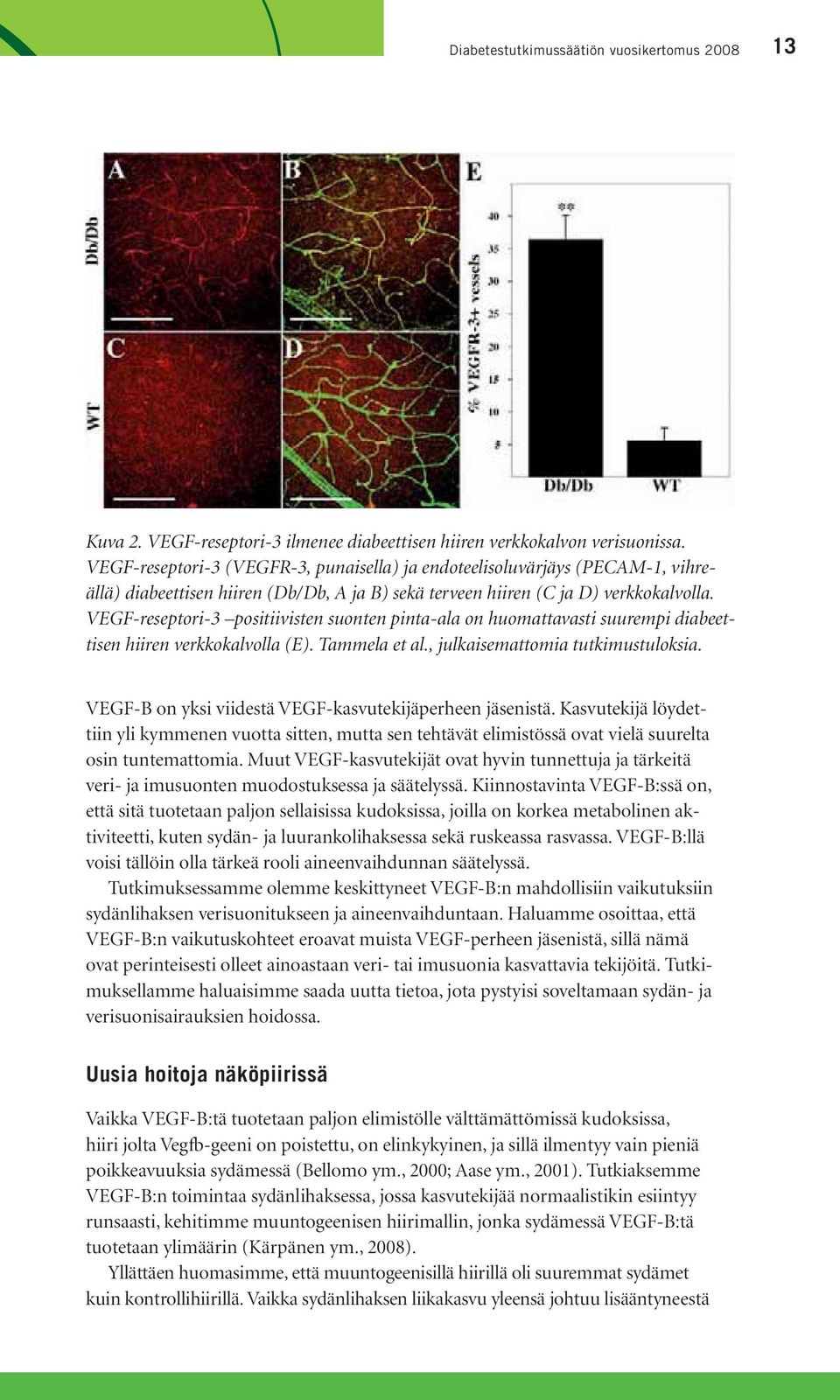 VEGF-reseptori-3 positiivisten suonten pinta-ala on huomattavasti suurempi diabeettisen hiiren verkkokalvolla (E). Tammela et al., julkaisemattomia tutkimustuloksia.