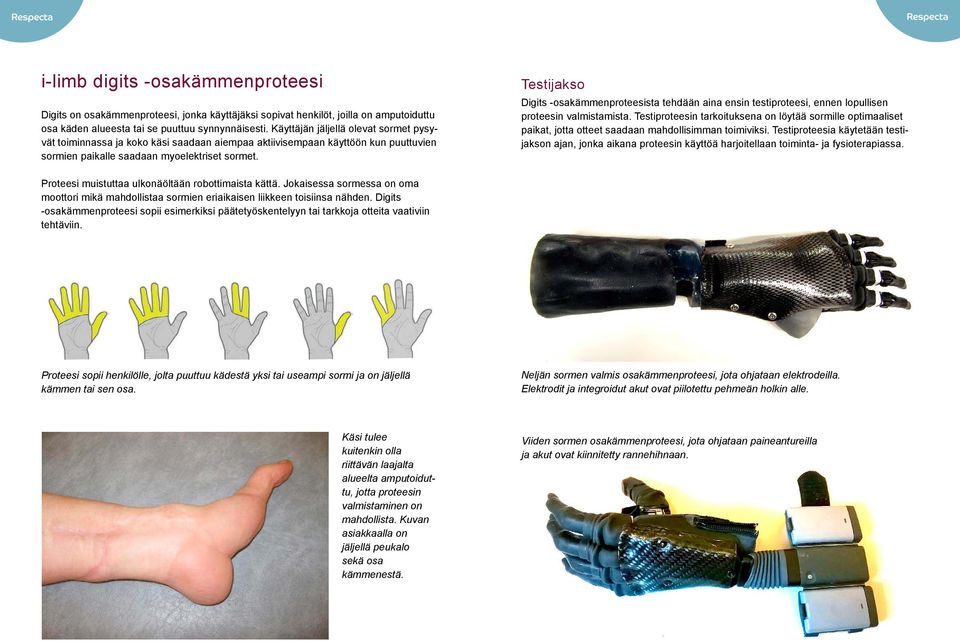 Testijakso Digits -osakämmenproteesista tehdään aina ensin testiproteesi, ennen lopullisen proteesin valmistamista.