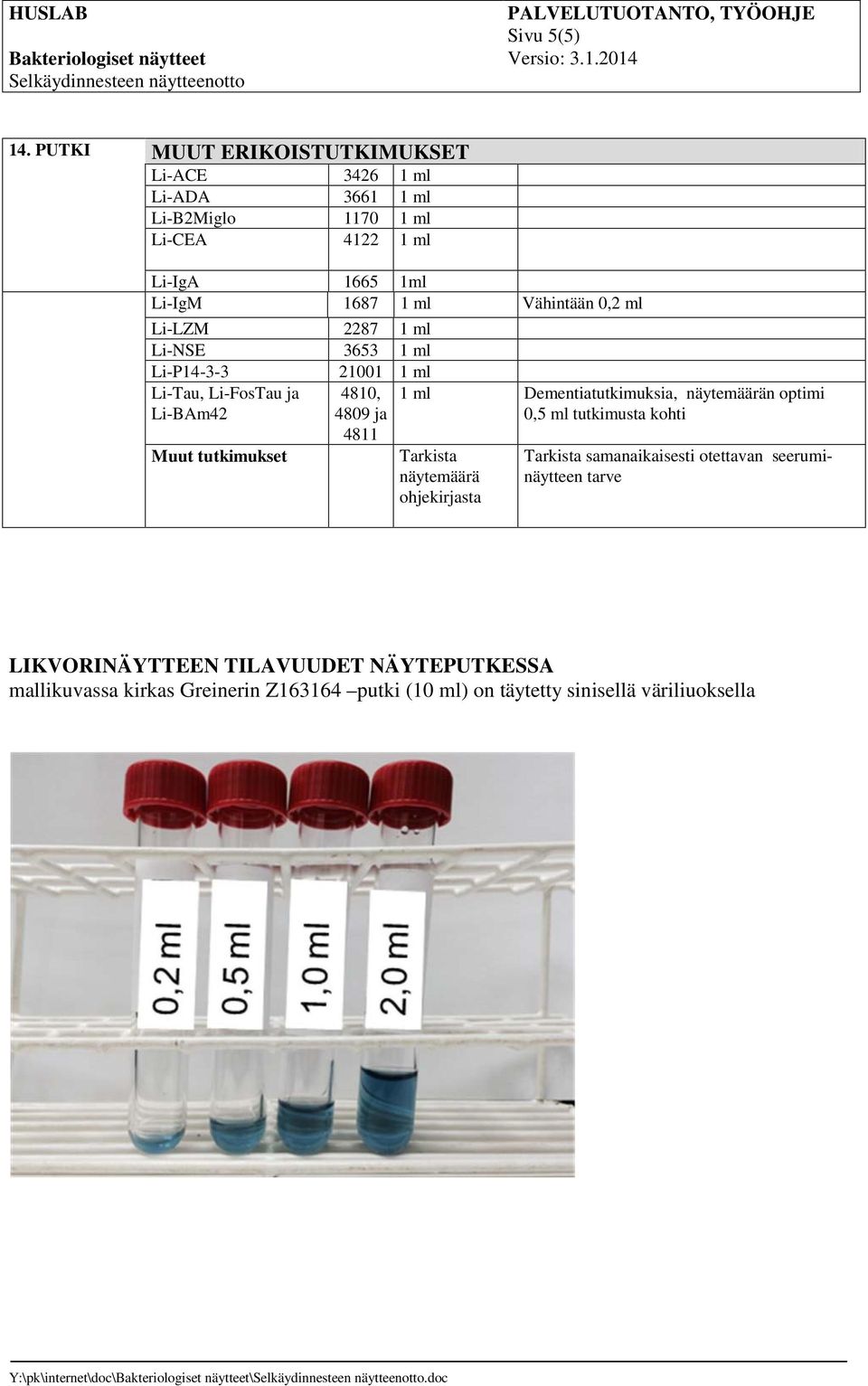 Vähintään 0,2 ml Li-LZM 2287 1 ml Li-NSE 3653 1 ml Li-P14-3-3 21001 1 ml Li-Tau, Li-FosTau ja Li-BAm42 Muut tutkimukset 4810, 4809 ja 4811 1 ml