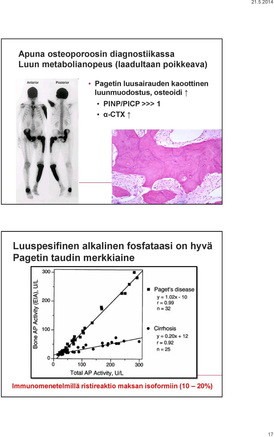 PINP/PICP >>> 1 α-ctx / / Luuspesifinen alkalinen fosfataasi on hyvä