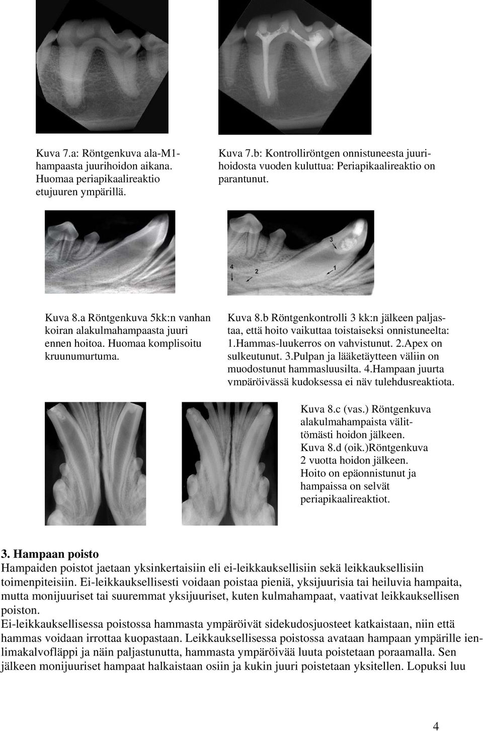 Huomaa komplisoitu kruunumurtuma. Kuva 8.b Röntgenkontrolli 3 kk:n jälkeen paljastaa, että hoito vaikuttaa toistaiseksi onnistuneelta: 1.Hammas-luukerros on vahvistunut. 2.Apex on sulkeutunut. 3.Pulpan ja lääketäytteen väliin on muodostunut hammasluusilta.