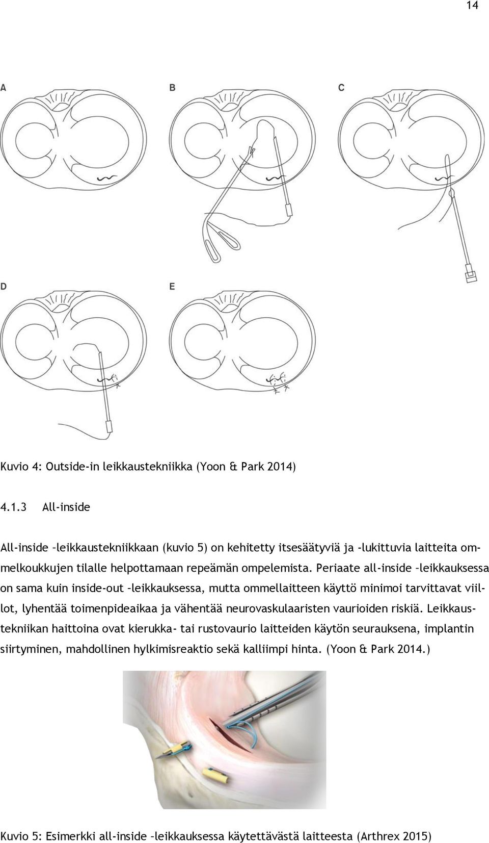 neurovaskulaaristen vaurioiden riskiä.