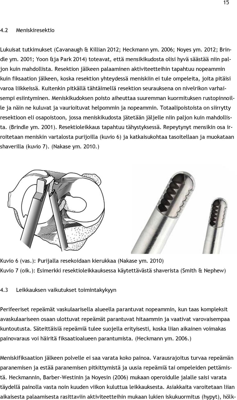 Resektion jälkeen palaaminen aktiviteetteihin tapahtuu nopeammin kuin fiksaation jälkeen, koska resektion yhteydessä meniskiin ei tule ompeleita, joita pitäisi varoa liikkeissä.