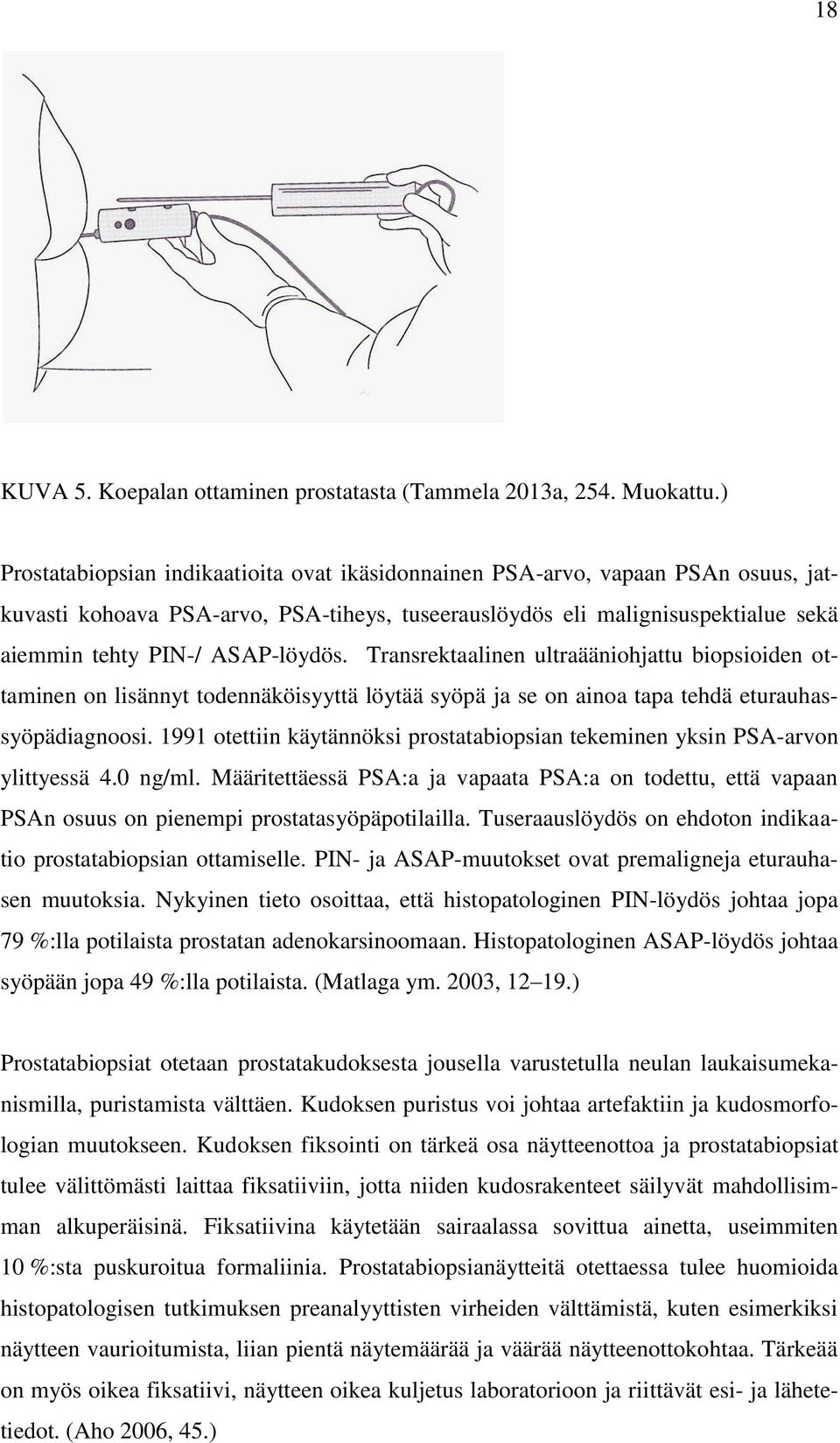 Transrektaalinen ultraääniohjattu biopsioiden ottaminen on lisännyt todennäköisyyttä löytää syöpä ja se on ainoa tapa tehdä eturauhassyöpädiagnoosi.