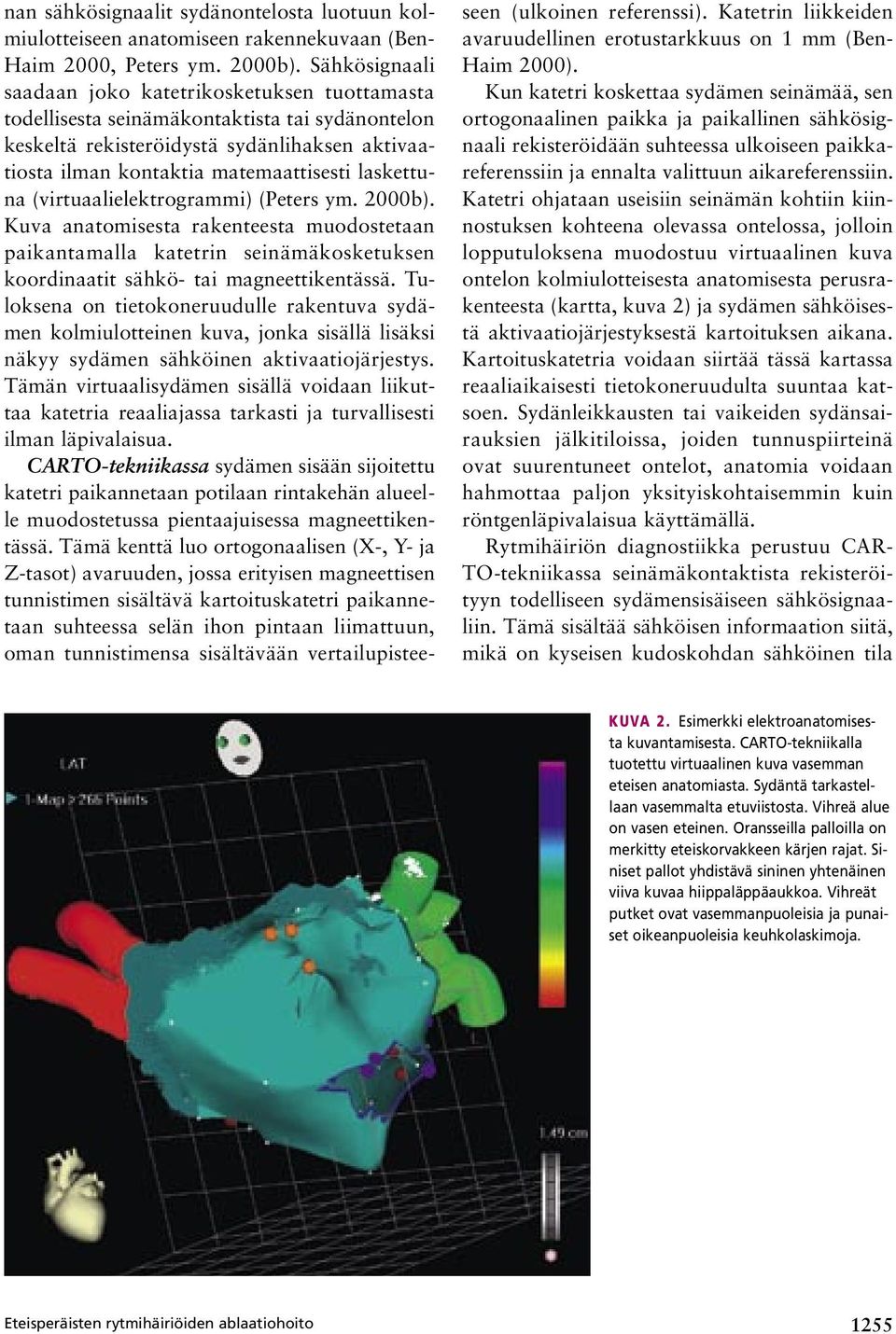 laskettuna (virtuaalielektrogrammi) (Peters ym. 2000b). Kuva anatomisesta rakenteesta muodostetaan paikantamalla katetrin seinämäkosketuksen koordinaatit sähkö- tai magneettikentässä.