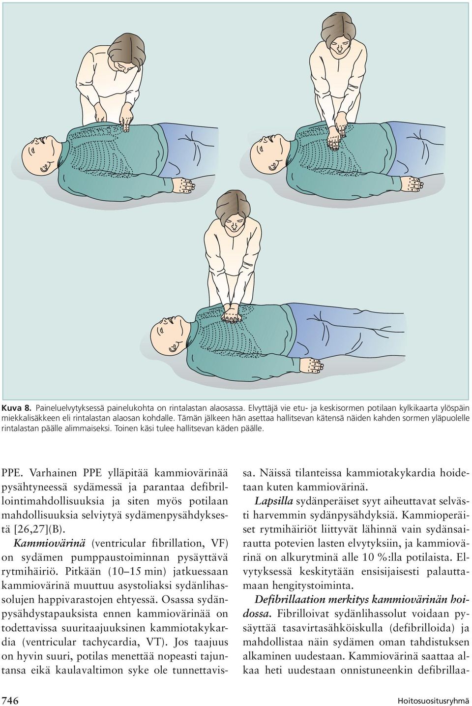 Varhainen PPE ylläpitää kammiovärinää pysähtyneessä sydämessä ja parantaa defibrillointimahdollisuuksia ja siten myös potilaan mahdollisuuksia selviytyä sydämenpysähdyksestä [26,27](B).