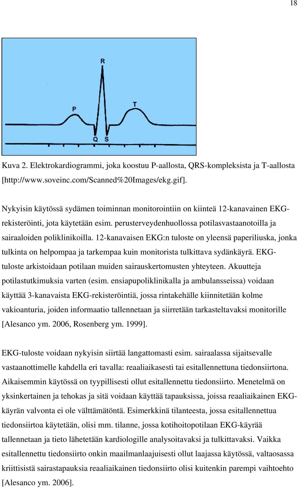 12-kanavaisen EKG:n tuloste on yleensä paperiliuska, jonka tulkinta on helpompaa ja tarkempaa kuin monitorista tulkittava sydänkäyrä.