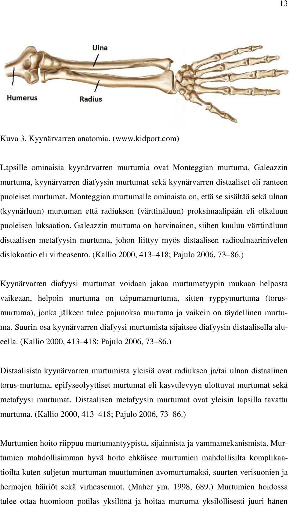 Monteggian murtumalle ominaista on, että se sisältää sekä ulnan (kyynärluun) murtuman että radiuksen (värttinäluun) proksimaalipään eli olkaluun puoleisen luksaation.