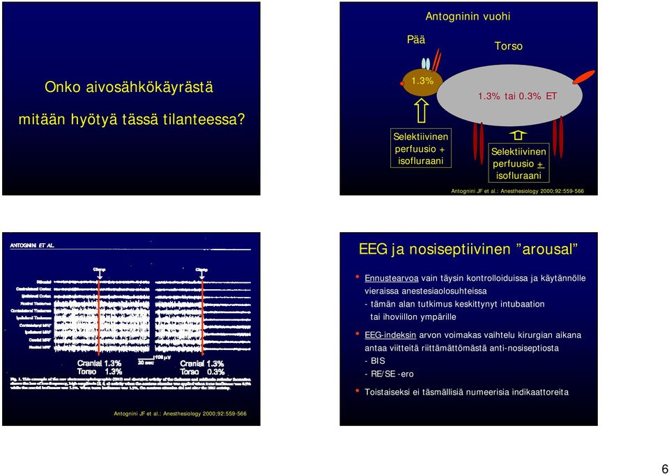 : Anesthesiology 2000;92:559-566 EEG ja nosiseptiivinen arousal Ennustearvoa vain täysin kontrolloiduissa ja käytännölle vieraissa anestesiaolosuhteissa - tämän