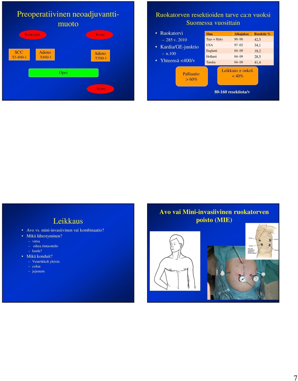 100 Yhteensä <400/v Maa Aikajakso Resektio % Tays + Hyks 90-98 42,5 USA 97-02 34,1 Englanti 04-09 18,2 Hollanti 04-09 28,5 Tanska 04-09 41,4 Oper