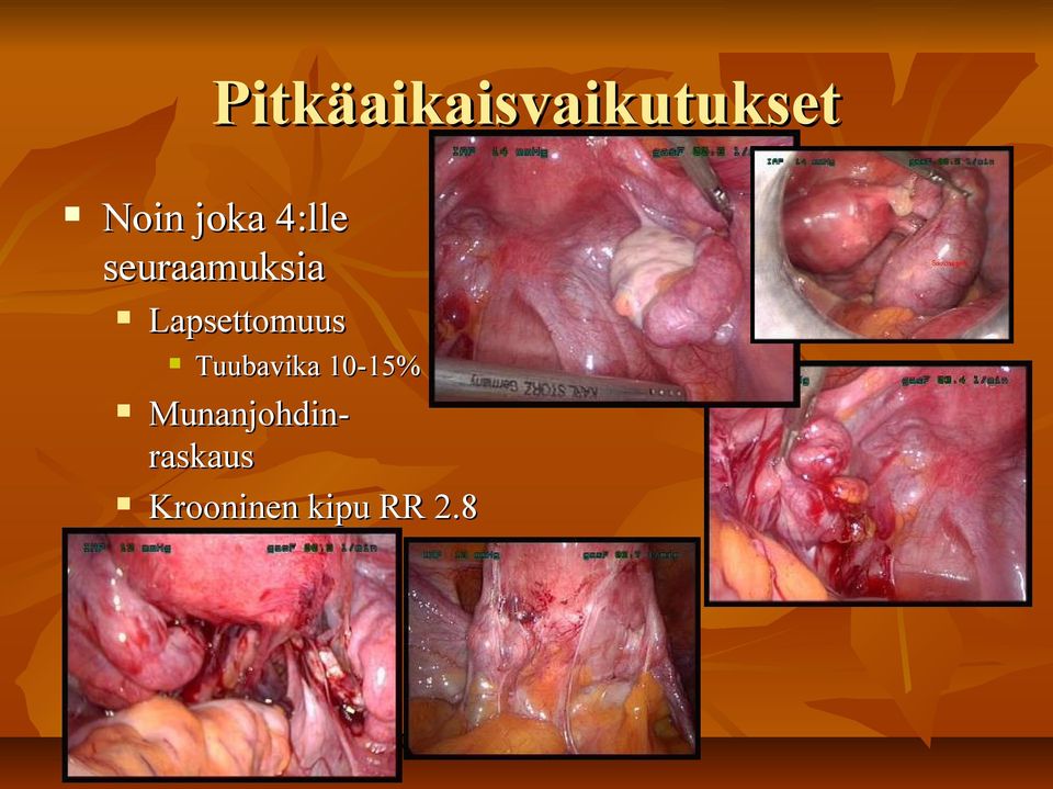 Lapsettomuus Tuubavika 10-15%