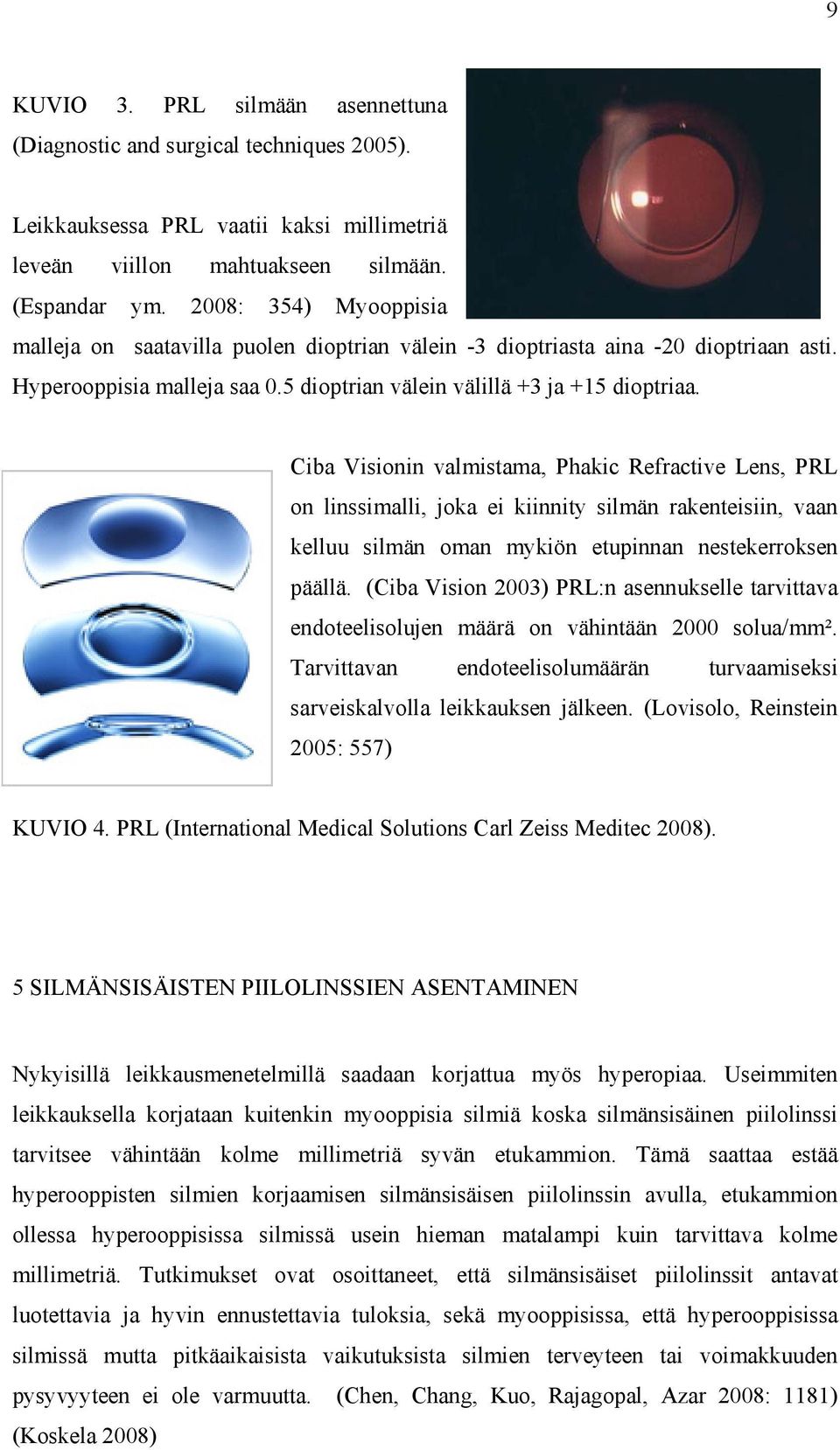 Ciba Visionin valmistama, Phakic Refractive Lens, PRL on linssimalli, joka ei kiinnity silmän rakenteisiin, vaan kelluu silmän oman mykiön etupinnan nestekerroksen päällä.