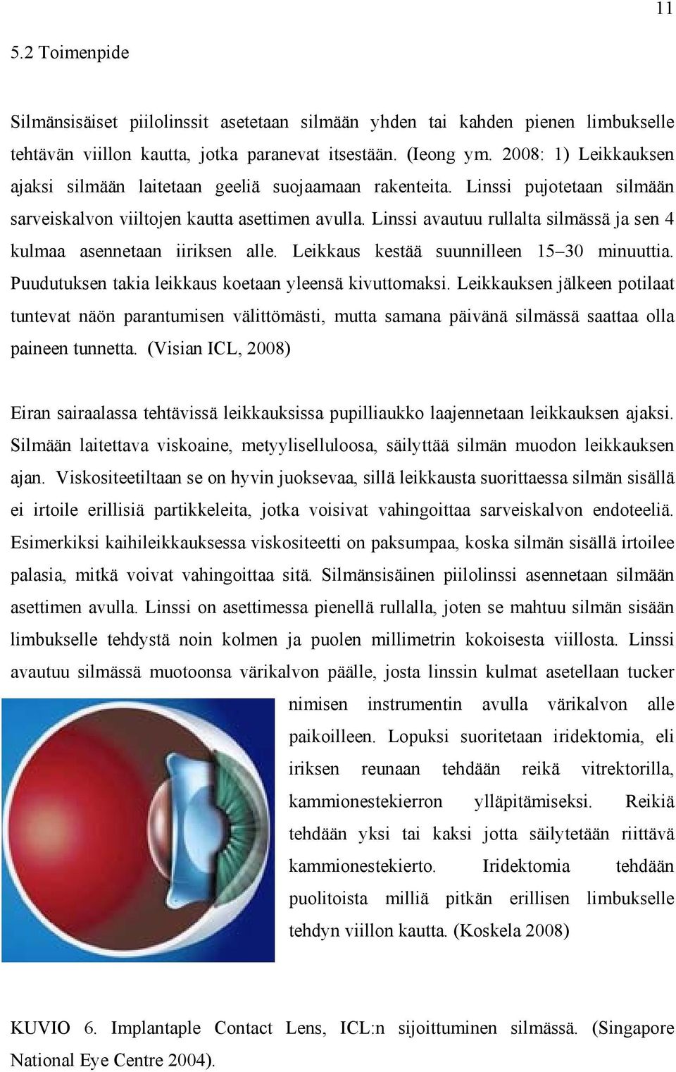 Linssi avautuu rullalta silmässä ja sen 4 kulmaa asennetaan iiriksen alle. Leikkaus kestää suunnilleen 15 30 minuuttia. Puudutuksen takia leikkaus koetaan yleensä kivuttomaksi.