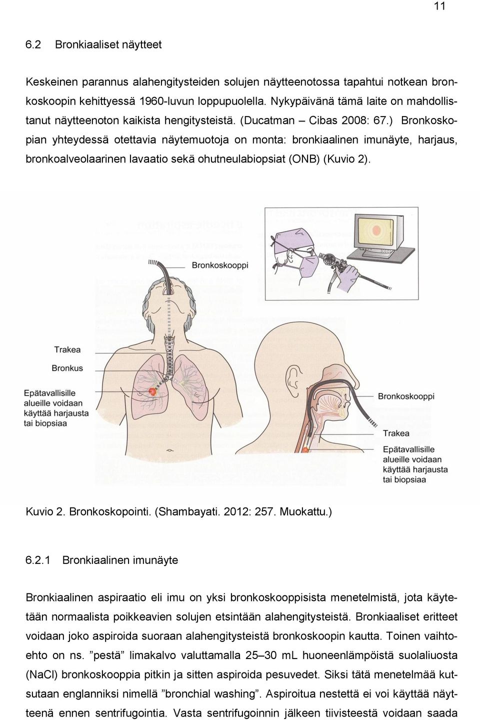 ) Bronkoskopian yhteydessä otettavia näytemuotoja on monta: bronkiaalinen imunäyte, harjaus, bronkoalveolaarinen lavaatio sekä ohutneulabiopsiat (ONB) (Kuvio 2). Kuvio 2. Bronkoskopointi. (Shambayati.