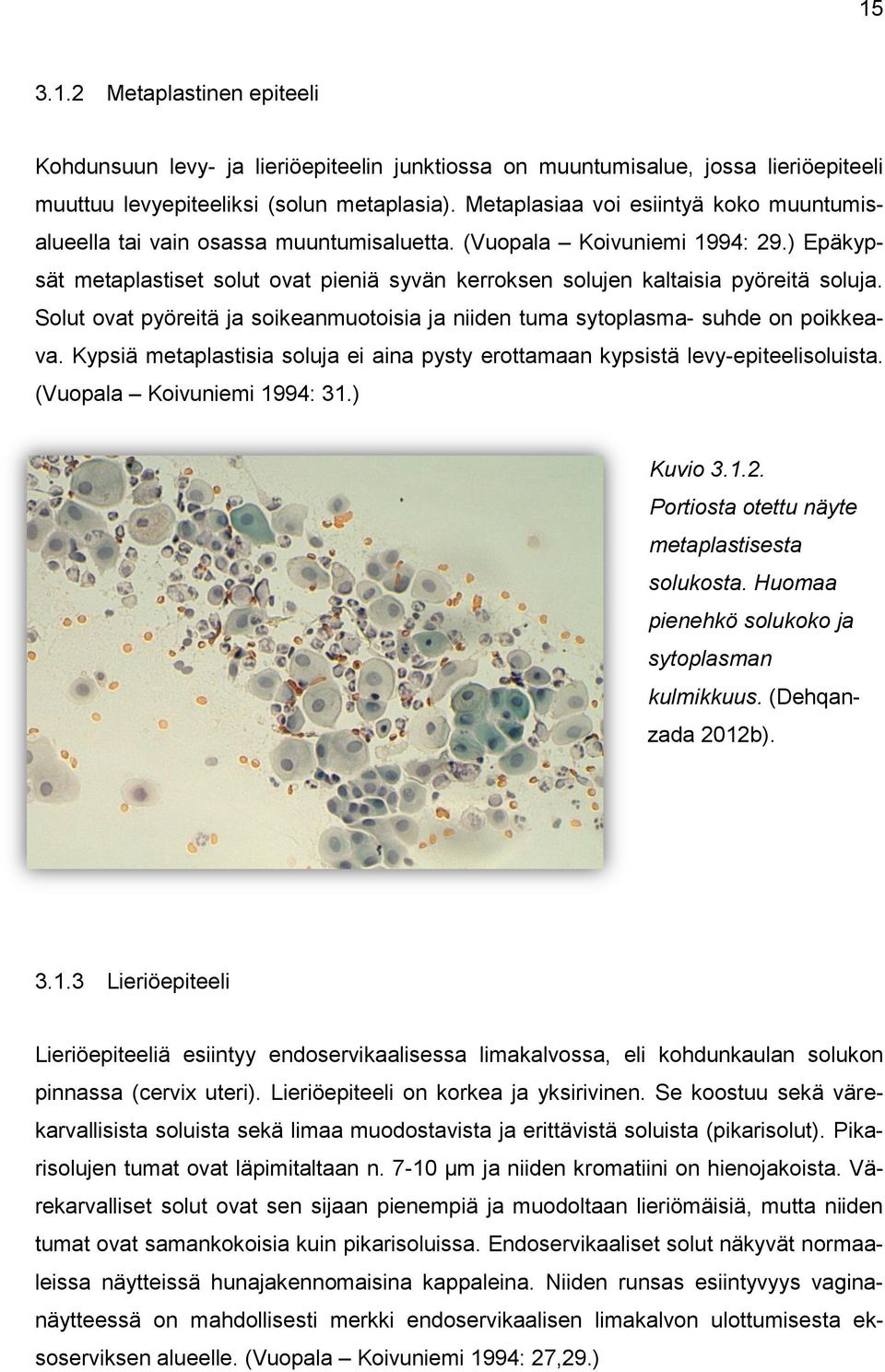 ) Epäkypsät metaplastiset solut ovat pieniä syvän kerroksen solujen kaltaisia pyöreitä soluja. Solut ovat pyöreitä ja soikeanmuotoisia ja niiden tuma sytoplasma- suhde on poikkeava.