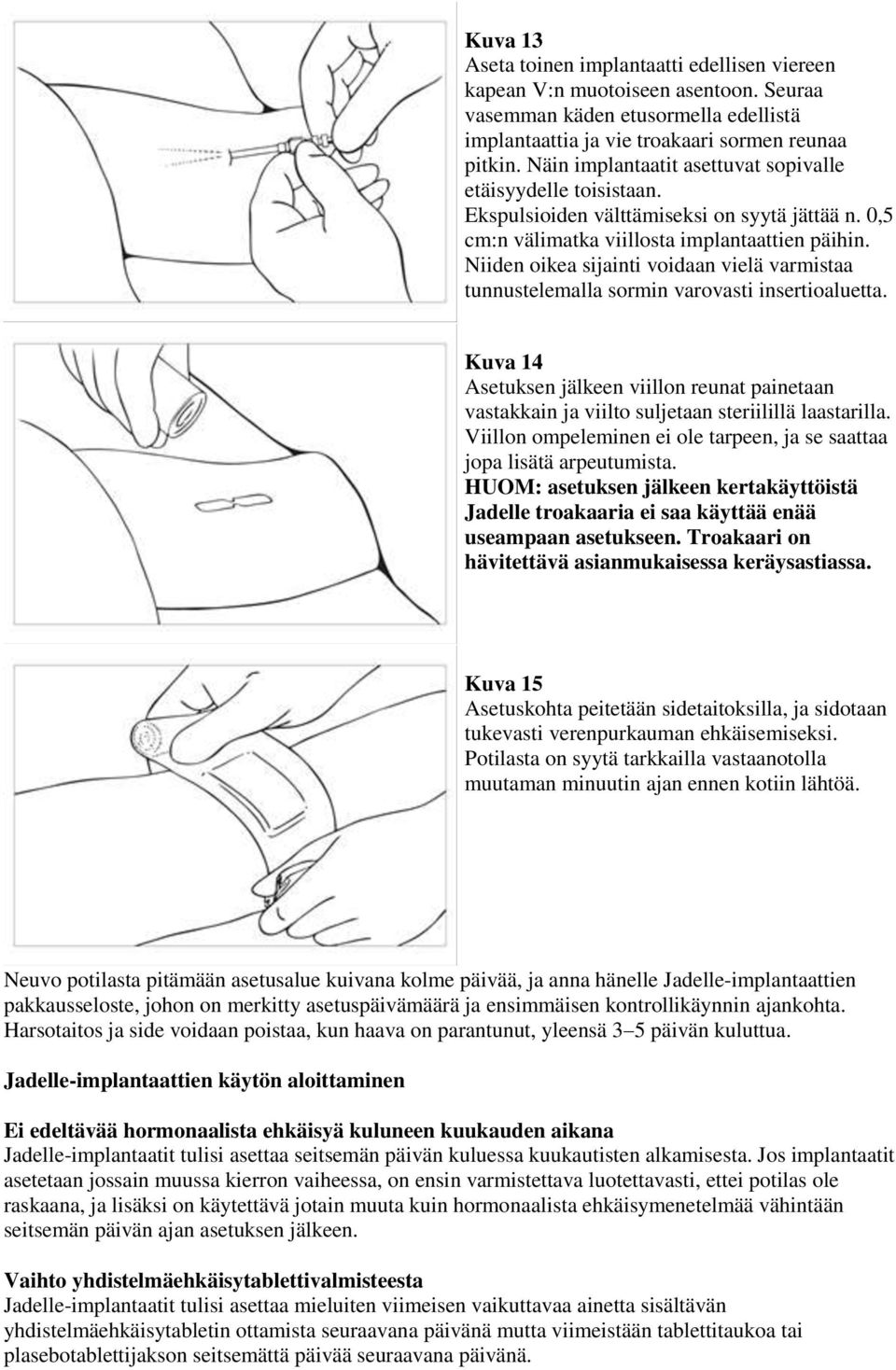 Niiden oikea sijainti voidaan vielä varmistaa tunnustelemalla sormin varovasti insertioaluetta.
