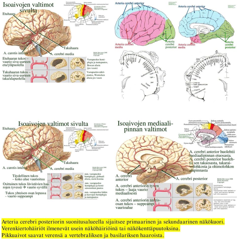 media Copyright Vastapuolen hemiplegia ja tuntopuutos, Brocan afasia (jos vasen) Vastapuolen näköpuutos, Wernicken afasia jos vasen media Arteria media Arteria Etuhaara Isoaivojen valtimot sivulta