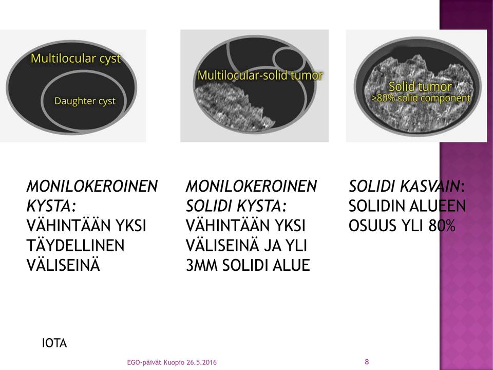 VÄLISEINÄ JA YLI 3MM SOLIDI ALUE SOLIDI KASVAIN: