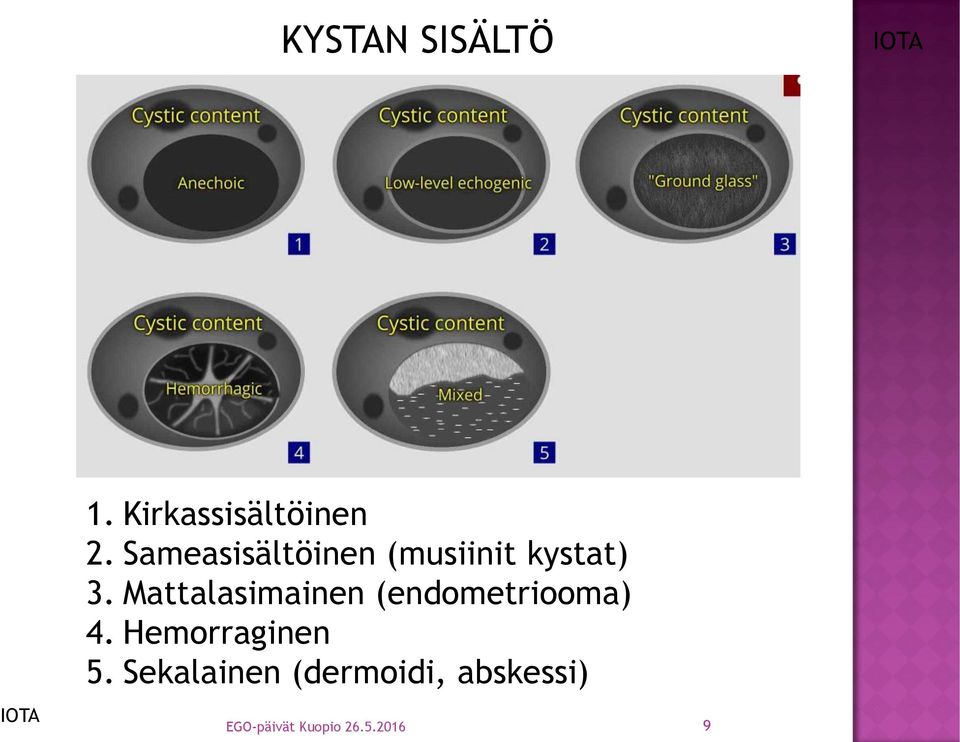 Mattalasimainen (endometriooma) 4. Hemorraginen 5.