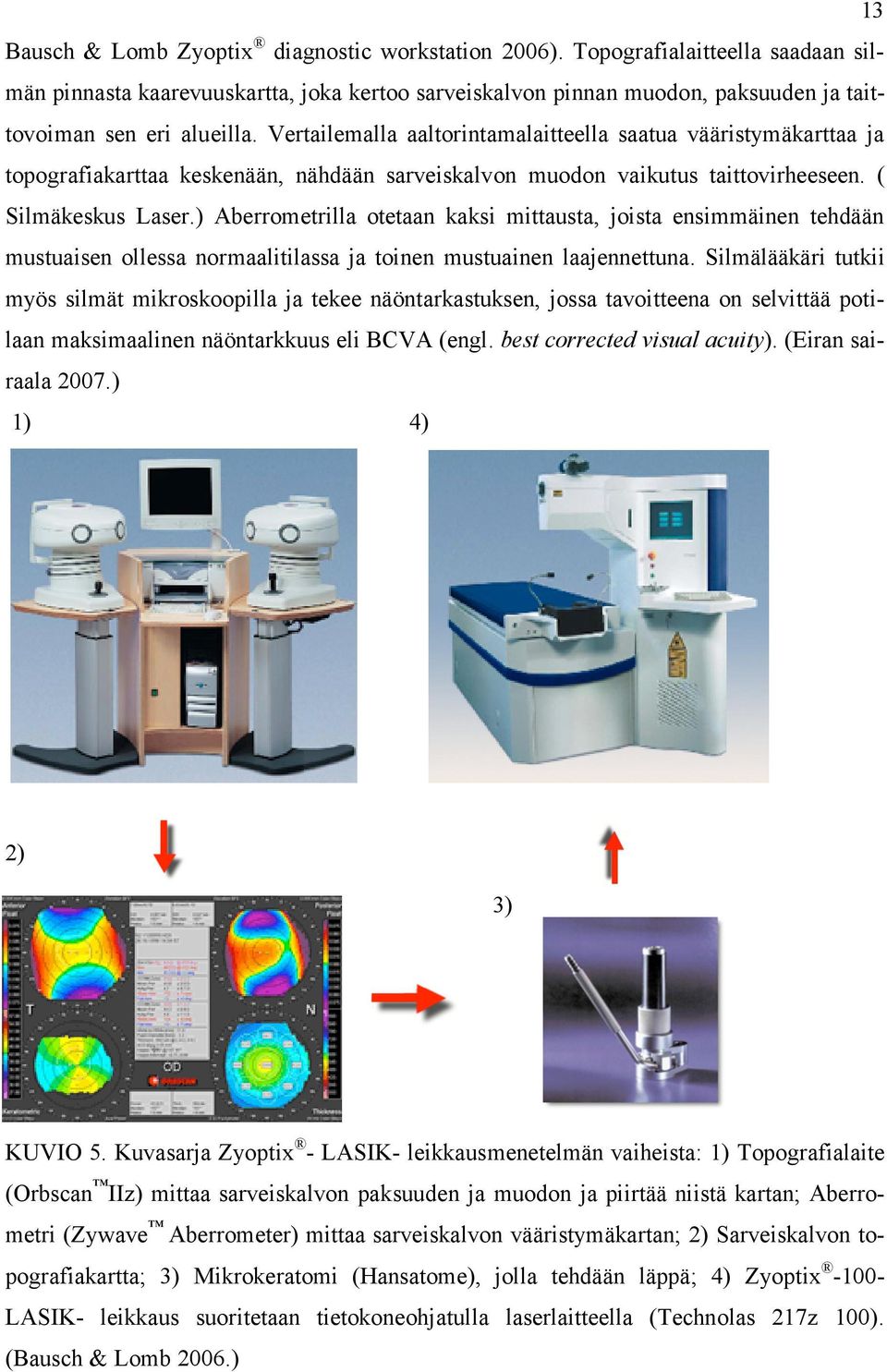 Vertailemalla aaltorintamalaitteella saatua vääristymäkarttaa ja topografiakarttaa keskenään, nähdään sarveiskalvon muodon vaikutus taittovirheeseen. ( Silmäkeskus Laser.