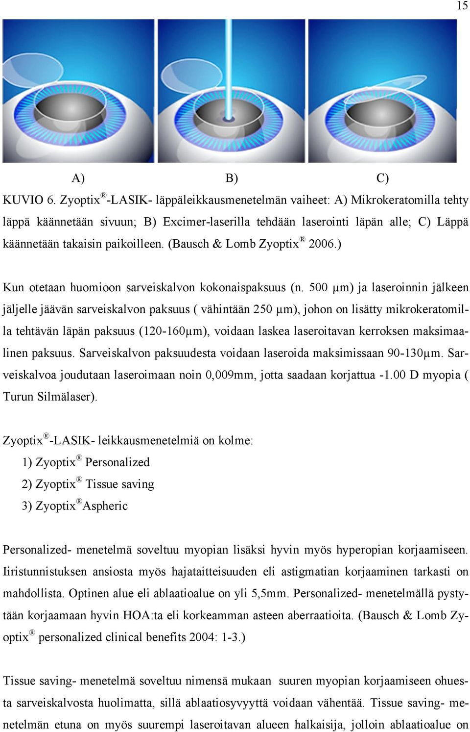 (Bausch & Lomb Zyoptix 2006.) Kun otetaan huomioon sarveiskalvon kokonaispaksuus (n.