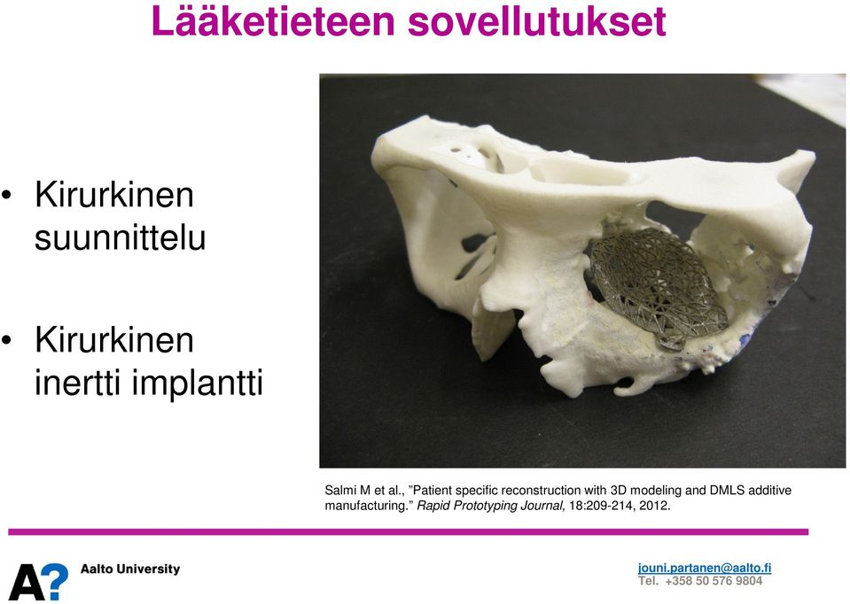 , Patient specific reconstruction with 3D modeling and