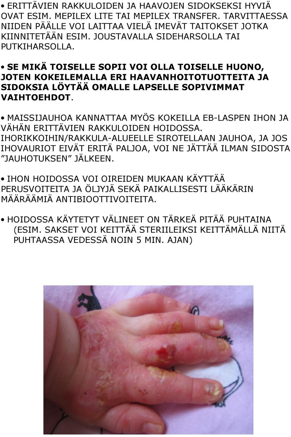 MAISSIJAUHOA KANNATTAA MYÖS KOKEILLA EB-LASPEN IHON JA VÄHÄN ERITTÄVIEN RAKKULOIDEN HOIDOSSA.