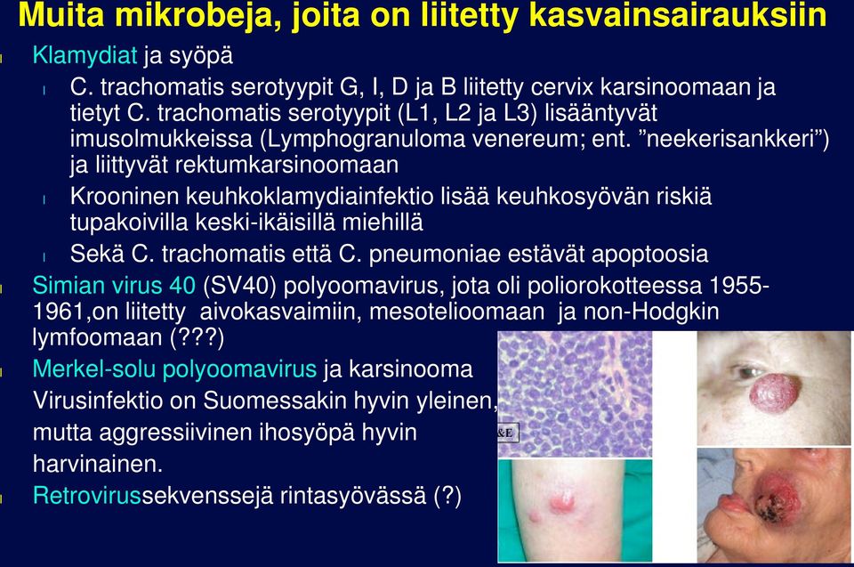 neekerisankkeri ) ja iittyvät rektumkarsinoomaan Krooninen keuhkokamydiainfektio isää keuhkosyövän riskiä tupakoivia keski-ikäisiä miehiä Sekä C. trachomatis että C.