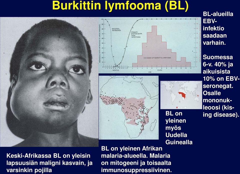 myös Uudea Guineaa BL on yeinen Afrikan maaria-aueea.